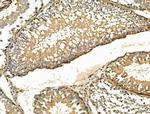 ENO1 Antibody in Immunohistochemistry (Paraffin) (IHC (P))