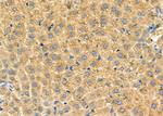 SLC27A2 Antibody in Immunohistochemistry (Paraffin) (IHC (P))