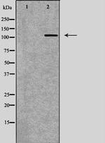 SERCA2 ATPase Antibody in Western Blot (WB)