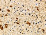 CYR61 Antibody in Immunohistochemistry (Paraffin) (IHC (P))