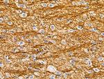 CYR61 Antibody in Immunohistochemistry (Paraffin) (IHC (P))