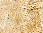 Cardiac Troponin T Antibody in Immunohistochemistry (Paraffin) (IHC (P))