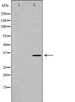 Cardiac Troponin T Antibody in Western Blot (WB)