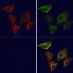 AMACR Antibody in Immunocytochemistry (ICC/IF)