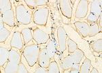 AMACR Antibody in Immunohistochemistry (Paraffin) (IHC (P))