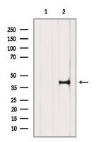 AMACR Antibody in Western Blot (WB)