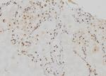 RRM1 Antibody in Immunohistochemistry (Paraffin) (IHC (P))