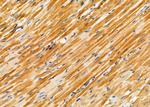 TPM1 Antibody in Immunohistochemistry (Paraffin) (IHC (P))