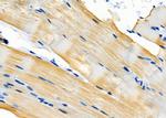 TPM1 Antibody in Immunohistochemistry (Paraffin) (IHC (P))