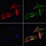 GluR3 Antibody in Immunocytochemistry (ICC/IF)