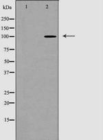 alpha Actinin 1 Antibody in Western Blot (WB)