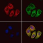 RHEB Antibody in Immunocytochemistry (ICC/IF)