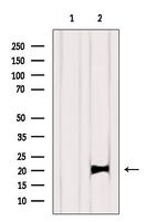 K-Ras Antibody in Western Blot (WB)