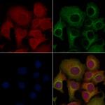 CD64 Antibody in Immunocytochemistry (ICC/IF)