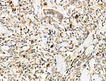 CD64 Antibody in Immunohistochemistry (Paraffin) (IHC (P))