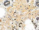 CD64 Antibody in Immunohistochemistry (Paraffin) (IHC (P))