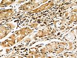 CD64 Antibody in Immunohistochemistry (Paraffin) (IHC (P))