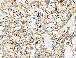 CD64 Antibody in Immunohistochemistry (Paraffin) (IHC (P))