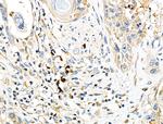 CD64 Antibody in Immunohistochemistry (Paraffin) (IHC (P))