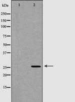 GSTM2 Antibody in Western Blot (WB)