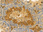 GSTM2 Antibody in Immunohistochemistry (Paraffin) (IHC (P))