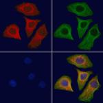 ATP6AP1 Antibody in Immunocytochemistry (ICC/IF)