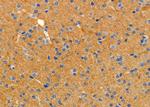 SRPX Antibody in Immunohistochemistry (Paraffin) (IHC (P))