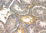 ITPA Antibody in Immunohistochemistry (Paraffin) (IHC (P))