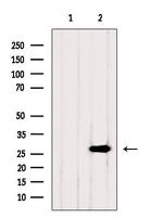 PSMA3 Antibody in Western Blot (WB)