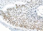 RBBP4 Antibody in Immunohistochemistry (Paraffin) (IHC (P))