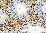 RBBP4 Antibody in Immunohistochemistry (Paraffin) (IHC (P))