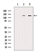 RENT1 Antibody in Western Blot (WB)