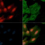 NFATC1 Antibody in Immunocytochemistry (ICC/IF)