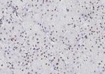 NFATC1 Antibody in Immunohistochemistry (Paraffin) (IHC (P))