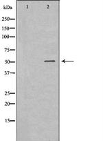 IL-6R Antibody in Western Blot (WB)