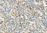 IL-6R Antibody in Immunohistochemistry (Paraffin) (IHC (P))