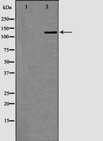 XPG Antibody in Western Blot (WB)