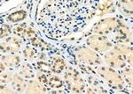 TAP2 Antibody in Immunohistochemistry (Paraffin) (IHC (P))