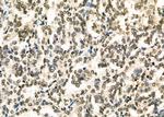 TAP2 Antibody in Immunohistochemistry (Paraffin) (IHC (P))