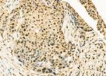 TAP2 Antibody in Immunohistochemistry (Paraffin) (IHC (P))