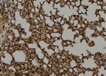 MUTYH Antibody in Immunohistochemistry (Paraffin) (IHC (P))