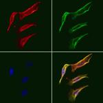 FABP2 Antibody in Immunocytochemistry (ICC/IF)