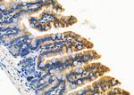 FABP2 Antibody in Immunohistochemistry (Paraffin) (IHC (P))