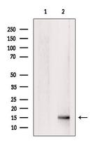 FABP2 Antibody in Western Blot (WB)