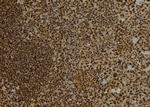 DTNBP1 Antibody in Immunohistochemistry (Paraffin) (IHC (P))