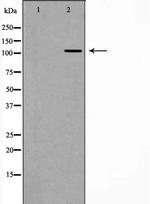 RASA1 Antibody in Western Blot (WB)