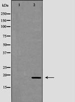 Cathelicidin Antibody in Western Blot (WB)