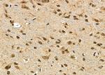 PTHLH Antibody in Immunohistochemistry (Paraffin) (IHC (P))