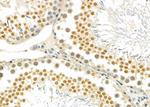 PTHLH Antibody in Immunohistochemistry (Paraffin) (IHC (P))