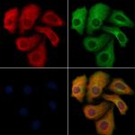 CD162 Antibody in Immunocytochemistry (ICC/IF)